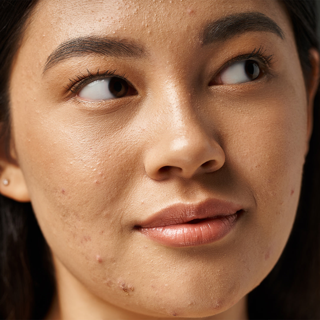 SKINPURE Nahrungsergänzungsmittel (INTB048)