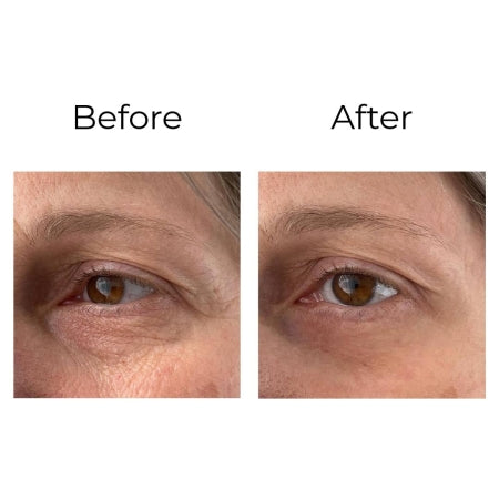 Peptilux – Anti-Falten Augencreme mit "Shock Action"-Effekt(LUX001)