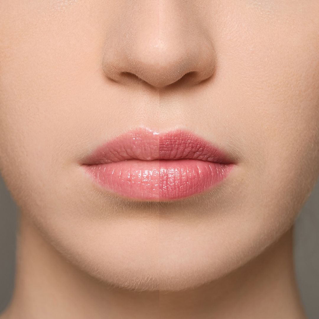 Supreme Lip Treatment – Erdbeere (MM003)